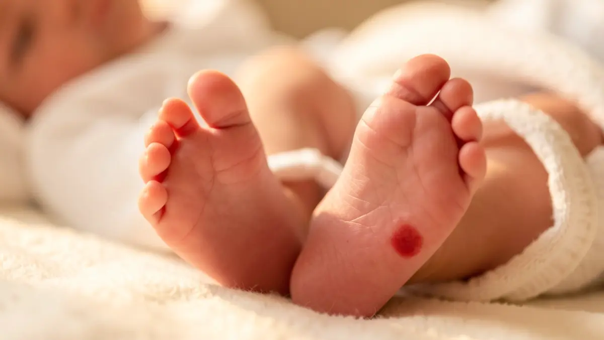 Close-up of a newborn baby's feet with a mark on the heel, symbolizing the heel prick test.